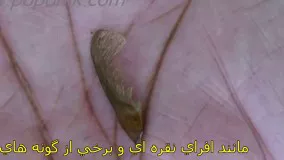 کاشت درخت افرا (زیرنویس فارسی)