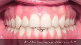 بهترين ارتودنسى براى بهترين جراحى فك