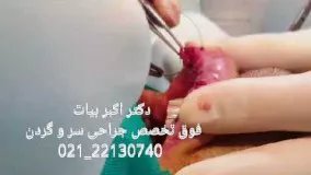 جراحی کوچک کردن لب پایین از داخل دهان