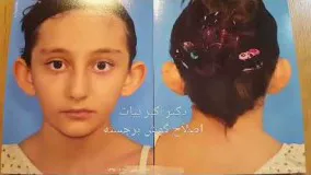 فیلم جراحی زیبایی گوش