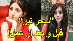 عکس های سحر تبر, عروس مردگان ایرانی قبل و بعد از عمل‌های جراحی!