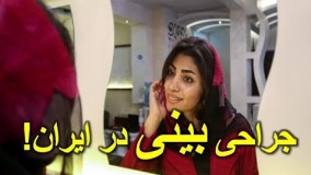 همه چیز دربارهٔ عمل جراحی بینی در میان دختران ایرانی! + تصاویر