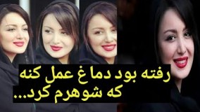 خانم بازیگر رفته بود دماغش رو عمل کنه، که شوهرم کرد!