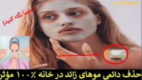 حذف دائمی موهای زائد در خانه ۱۰۰% مؤثر (حتماً نگاه کنید)