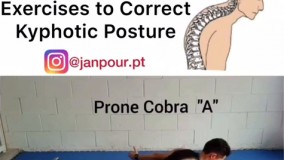 درمان قوز پشت با فیزیوتراپی در منزل 09122655648طراحی سایت پزشکی