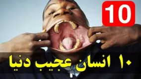 10انسان عجیب دنیا که باور نمیکنید واقعی باشند