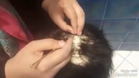 تعمیرات پروتز مو