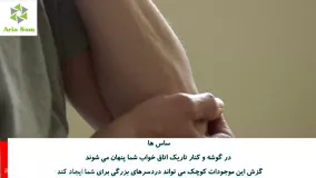 خداحافظی با ساس ها و عوارض ناشی از گزیدگی آن ها