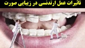 کلیپ های عجیب و جالب-ارتودنسی عمل زیبایی دندان کریستیانو رونالدو