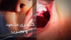 متخصص کاشت ایمپلنت دندان|کلینیک دندانپزشکی مدرن