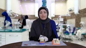 نکات تحویل روکش ایمپلنت|کلینیک مدرن