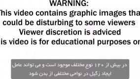زگیل چیست و انواع آن /زگیل تناسلی در زنان و مردان (https://hpvdarman.com/)