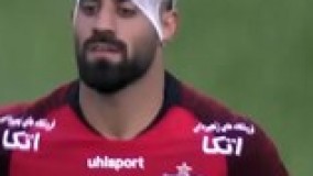 شکستن سر بازیکن با سنگ تماشاگر در بازی دربی-محمد حسین کنعانی زادگان