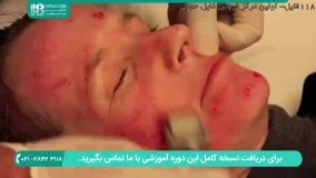 درمارولر چیست؟ | پاکسازی و شفافیت پوست صورت