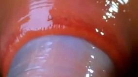 لحظه بلعیده شدن کرم خاکی توسط زالوی هیولا