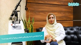 عمل زیبایی واژن