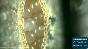 بهترین راه برای دفع تخم سوسک | سم سوسک کش خارجی