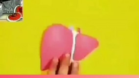 علائم کبد چرب چیست؟