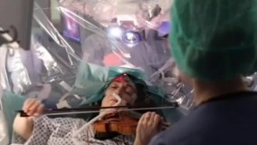 جراحی مغز حین ویولون زدن توسط پزشک ایرانی