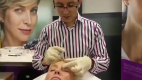 بوتاکس ابرو - بالاکشیدن ابرو - دکتر دوغایی مقدم