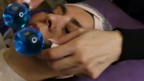 فیشیال (پاکسازی پوست) در کلینیک ارکیده