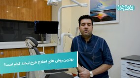 اصلاح طرح لبخند