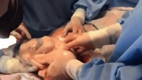 تصاویری بی‌نظیر از یک نوزاد در بیمارستان!