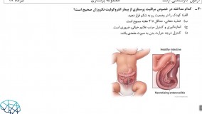 حل تشریحی درس کودکان ارشد پرستاری سال 98