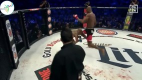 بدترین مصدومیت ها در طول تاریخ مبارزات آزاد