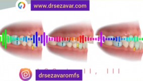 اصلاح روابط فکی