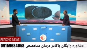 درمان قطعی شوره ی سرچیست؟