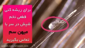 شپش ها چه شکلی هستند؟ | شامپو شپش برای دفع سریع شپش از سر