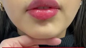 ژل لب کلاسیک