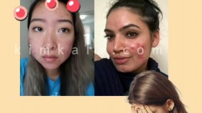 صابون ضد آکنه/09120132883/صابون گوگرد