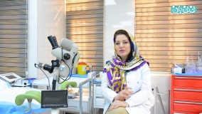 مقایسه انواع آی یو دی