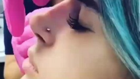 اصلاح قوز بینی