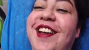 لیپو غبغب - بعد از عمل