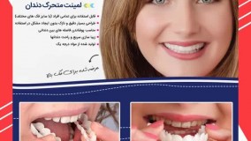 خرید لمینت متحرک دندان-09363660478