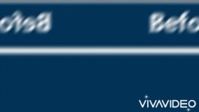 عمل جراحی غبغب شیراز