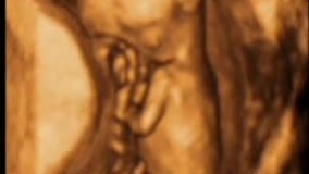 سونوگرافی چهار بعدی در بارداری هفته سیزدهم