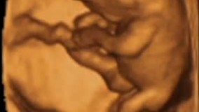 سونوگرافی چهار بعدی در بارداری هفته نهم