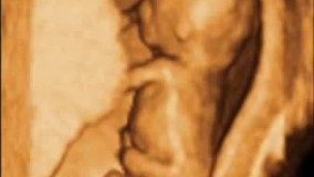 سونوگرافی چهار بعدی در بارداری هفته دوازدهم