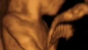 سونوگرافی چهار بعدی در بارداری هفته یازدهم - 1