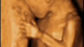 سونوگرافی چهار بعدی در بارداری هفته نوزدهم