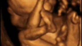 سونوگرافی چهار بعدی در بارداری هفته شانزدهم