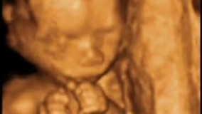 سونوگرافی چهار بعدی در بارداری هفته هفدهم