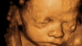 سونوگرافی چهار بعدی در بارداری هفته بیست و هفتم