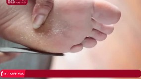 پدیکور - آموزش پدیکور پا به همراه پاکسازی کامل