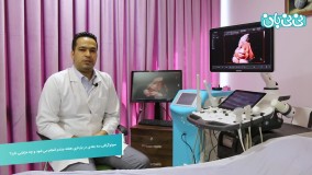 زمان انجام سونوگرافی سه بعدی بارداری