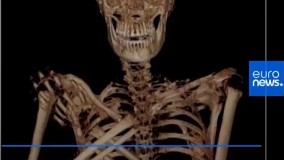 شگفتی محققان از یافتن جنین در مومیایی ۲ هزار ساله